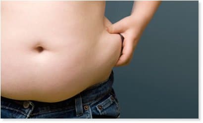 Obesità e chirurgia bariatrica