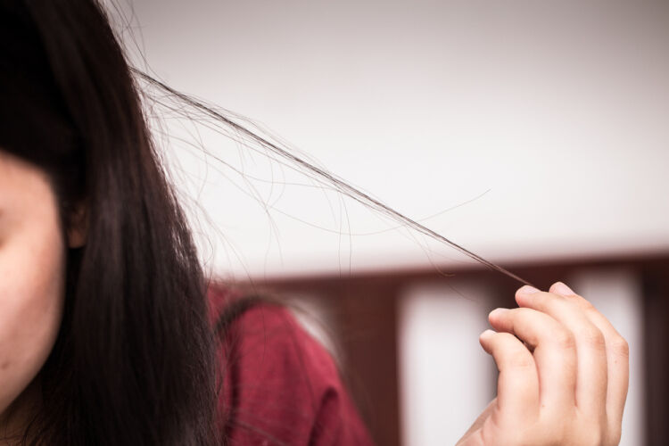Tricotillomania: il bisogno irresistibile di strapparsi i capelli
