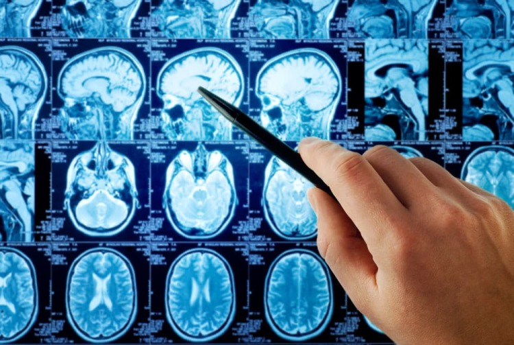 Neuropsicologia